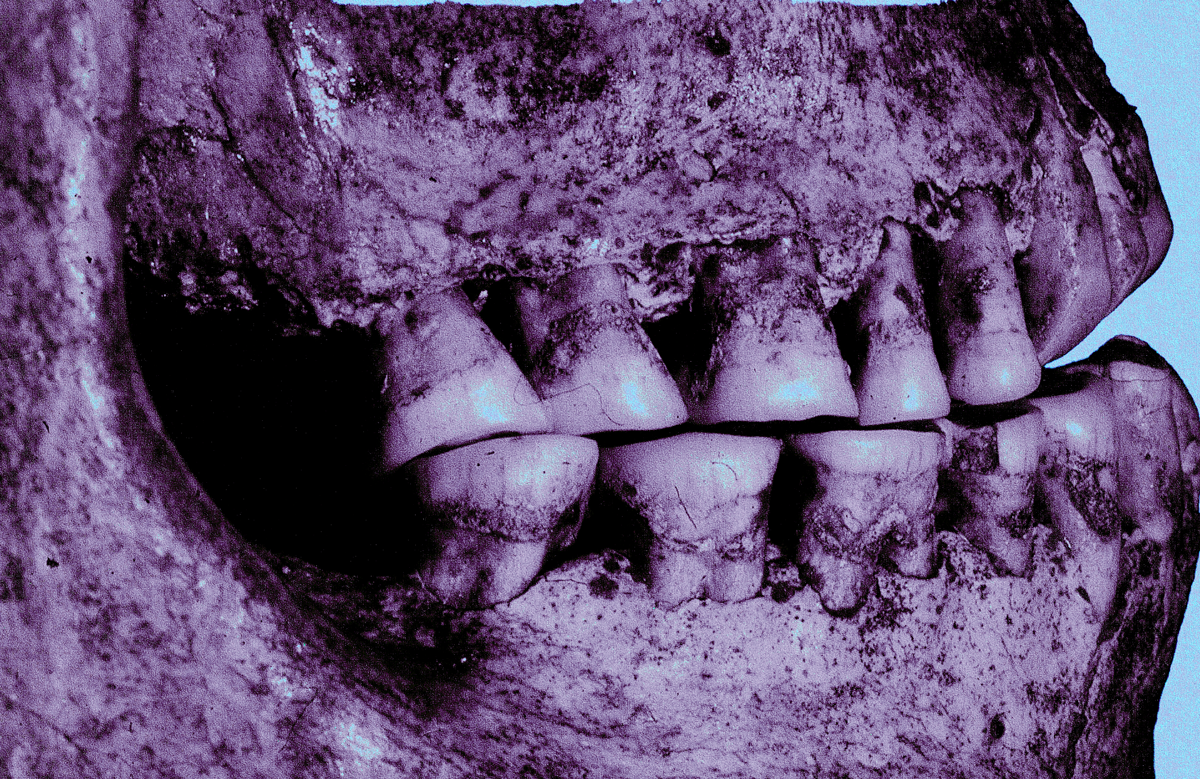 The Mythology of Teeth